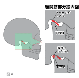 顎関節のイラスト